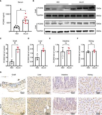 Targeting PCSK9 Ameliorates Graft Vascular Disease in Mice by Inhibiting NLRP3 Inflammasome Activation in Vascular Smooth Muscle Cells